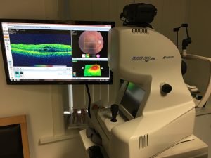 3D OCT Image and Scan