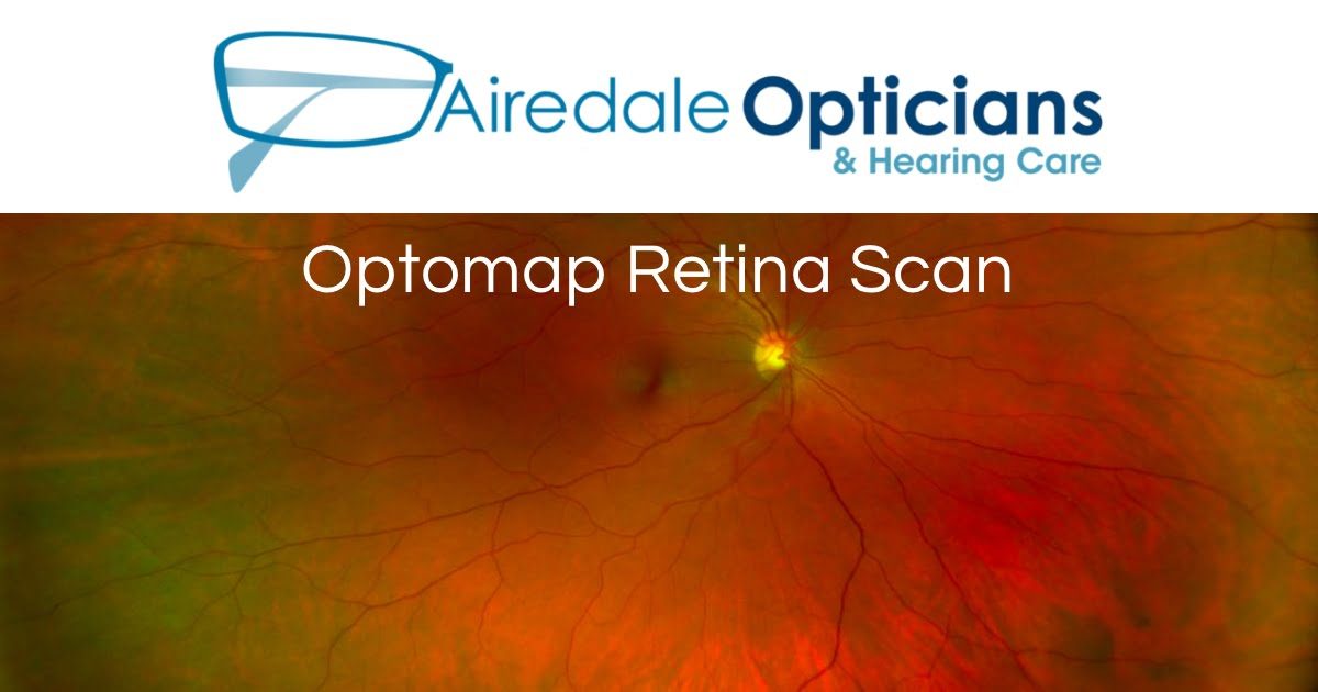 Optomap